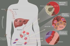 What is Malaria